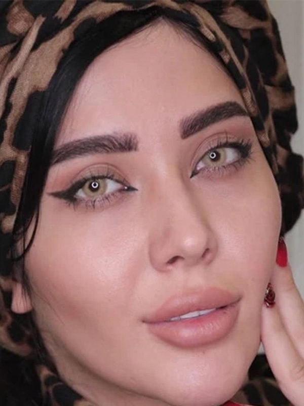 ترسا لاکچری - گلد آی - عسلی طلایی فانتزی- کد 5011