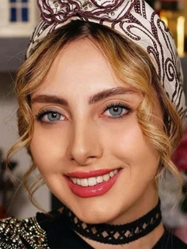 ترسا لاکچری - لنابلو - آبی دوردار