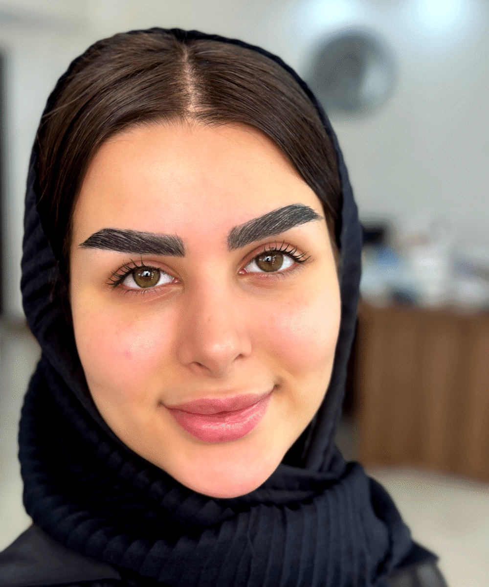 ميني آوا - اليواگرين